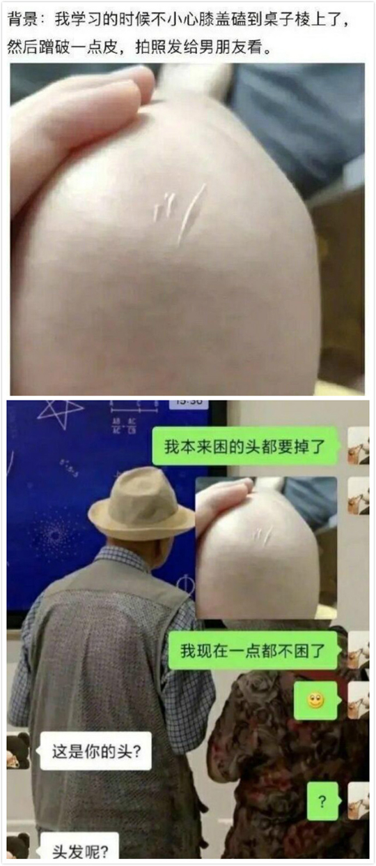 没错啊,克膝头得嘛