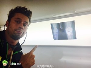 雅马哈Tech 3车手Bradley smith伤后拍的X光片,好屌