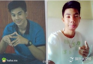 菲律宾男模为了省钱只花70块钱整鼻子和下巴 结果…