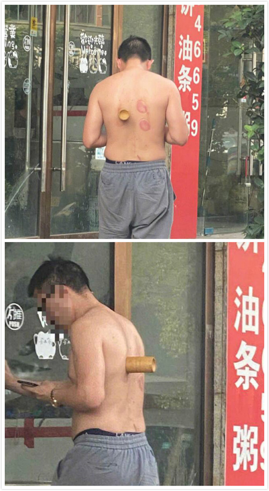 火烧赤背