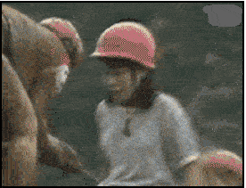 还好戴着帽子呢，看着都疼啊