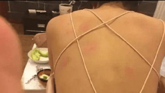 妹子的衣服很个性,就是蚊子有点多,背上都是红印子。